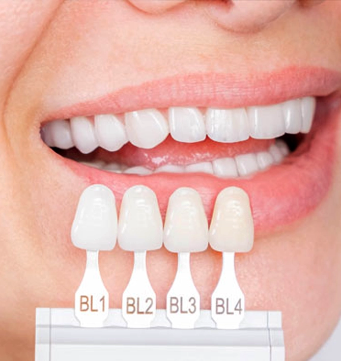 Composite Bonding