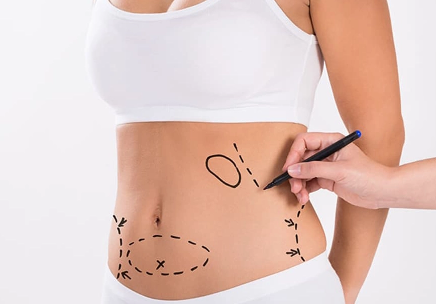 Advanced Liposuction