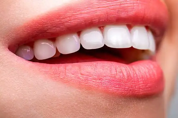 Natural Tooth Integration