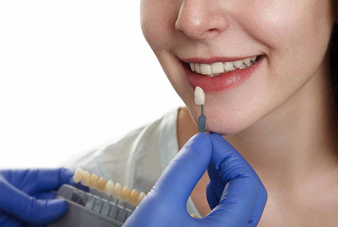 Perfect Smile Result
