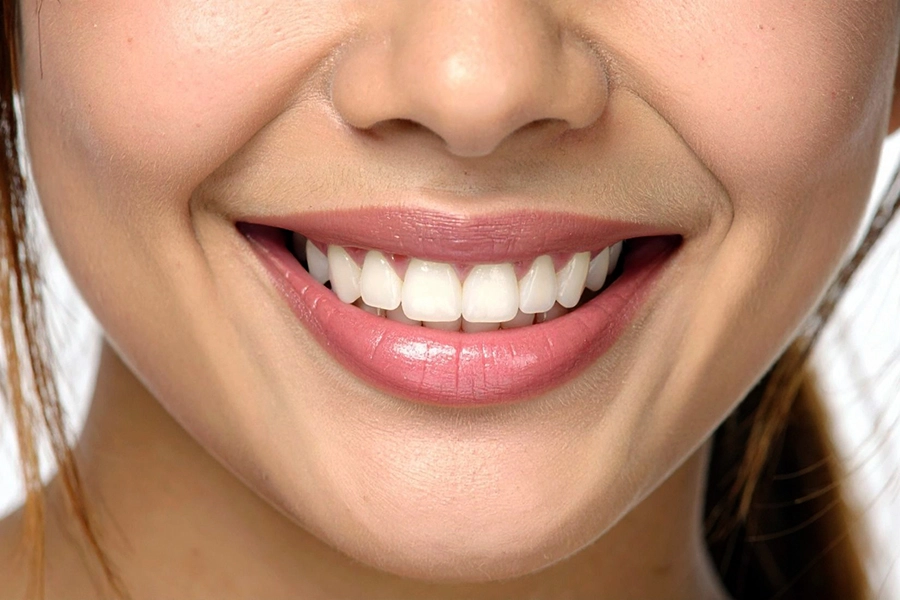 Gum Contouring Result