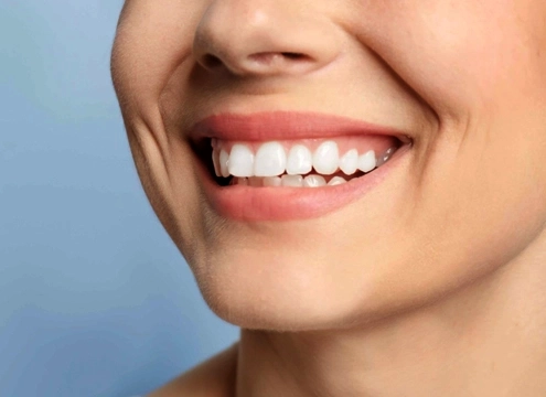 Gum Contouring Result