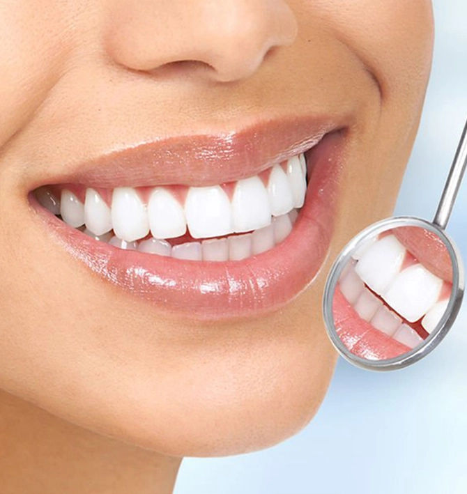 Hollywood Smile