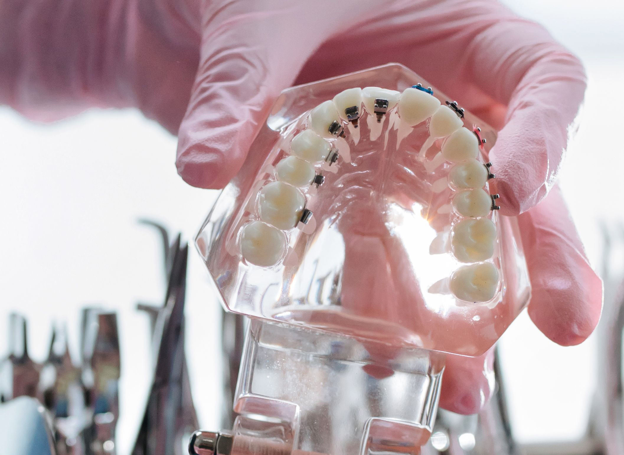Dental Implants in Turkiye