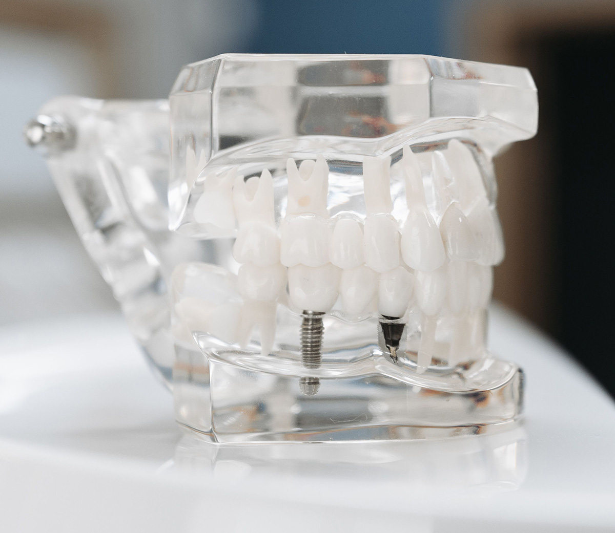 Modern Dental Clinic in Turkiye