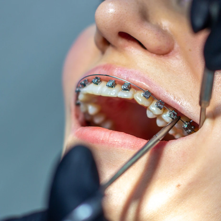 General Dental Services